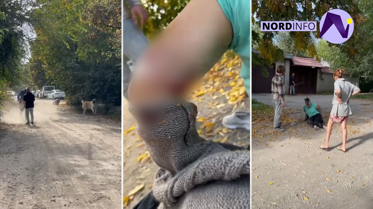 VIDEO // O femeie din Bălți s-a ales cu răni grave după ce a fost atacată de un câine