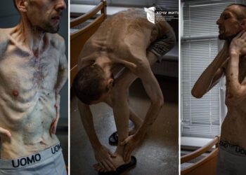 FOTO | Imagini șocante cu un prizonier ucrainean după doi ani de captivitate în Rusia. „Evocă cele mai întunecate pagini ale istoriei umane”