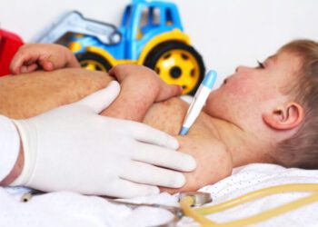 117 cazuri de rujeolă de la începutul anului. ANSP: Boala poate fi prevenită prin vaccinare
