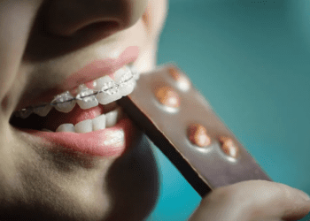 Ce și cum trebuie să mănânci dacă porți aparat dentar