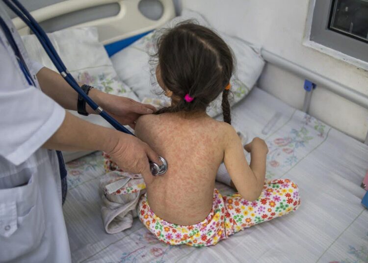 Ministra Sănătății avertizează părinții că rujeola a revenit în regiune și îi îndeamnă să vaccineze copiii