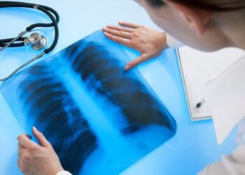 Туберкулёз поражает сотни молдаван. Прогресс в лечении, но сохраняются устойчивые формы