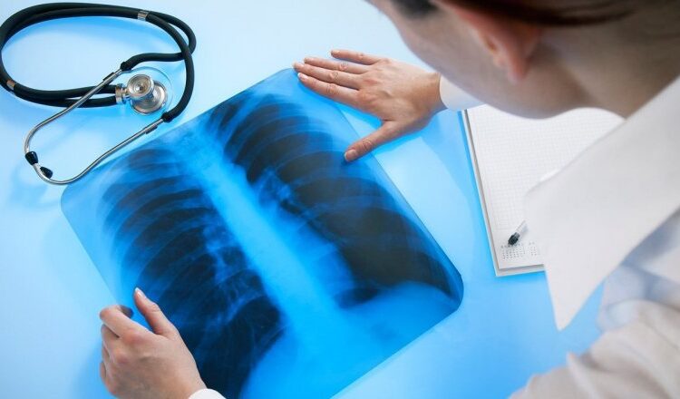 Туберкулёз поражает сотни молдаван. Прогресс в лечении, но сохраняются устойчивые формы