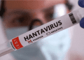 În România a fost confirmat primul caz de infectare cu hantavirus