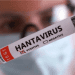 În România a fost confirmat primul caz de infectare cu hantavirus