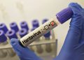 În Ucraina se înregistrează zeci de cazuri de hantavirus. De ce este foarte important să nu fie măturate zonele