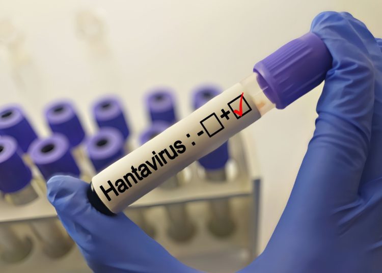 În Ucraina se înregistrează zeci de cazuri de hantavirus. De ce este foarte important să nu fie măturate zonele